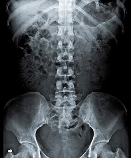 Radiografía
